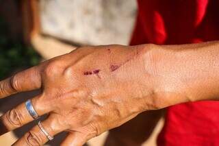 Édna mostra ferimento e diz que foi agredida pelo filho durante a confusão (Foto: Henrique Kawaminami) 