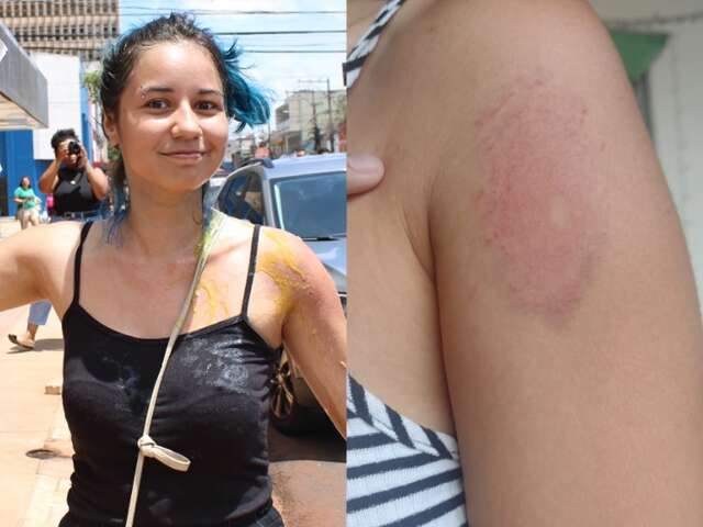 &ldquo;Foi humilhante&rdquo;, diz estudante agredida durante manifesta&ccedil;&atilde;o da UFMS 