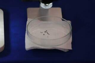 Larvas de mosquito Aedes aegypt em lâmina de microscópio. (Foto: Marcos Maluf/Arquivo)