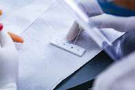 Neste ano, 75% dos leitores não precisaram fazer teste de covid-19