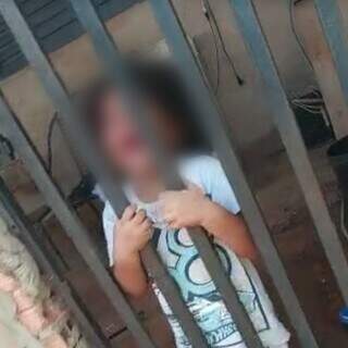 Rapaz que denunciou abandono &eacute; agredido e acusa m&atilde;e de crian&ccedil;as