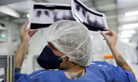 Pacientes com suspeita de tuberculose terão acesso prioritário a raio-x em UPAs