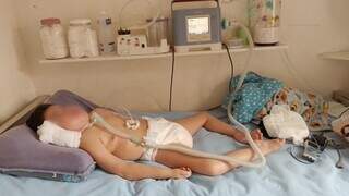 Criança sofre com síndrome rara e precisa de monitoramento 24h (Foto: Arquivo pessoal)