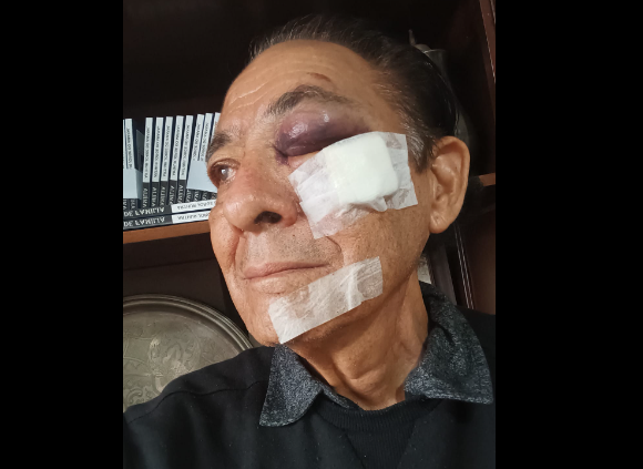 Ex-deputado estadual e escritor sofre queda em falha de cal&ccedil;ada e fica ferido 