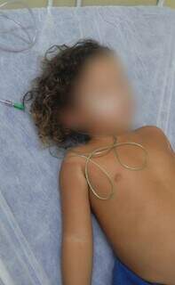 Menino de três anos com broncopneumonia e derrame no pulmão, no CRS Tiradentes, ontem (30). (Foto: Direto das Ruas)