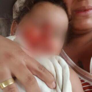 Criança de dois anos foi atacada por rotweiller da família. (Foto: Direto das Ruas)