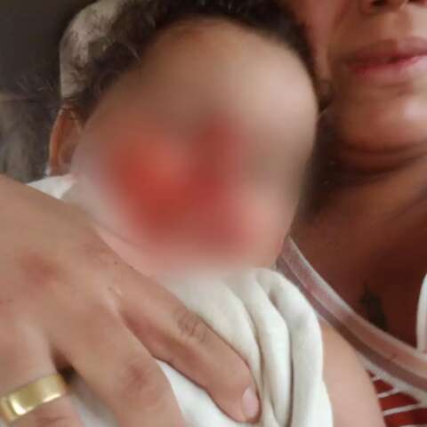 Rotweiller ataca crian&ccedil;a de dois anos no Jardim Noroeste