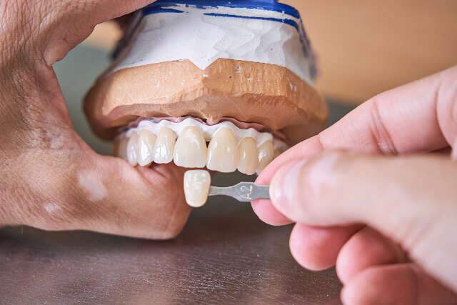 A prótese total pode melhorar a sua saúde bucal