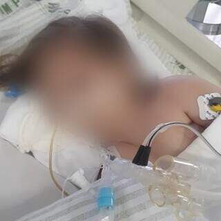 Bebê de um ano e cinco meses está internada, em estado grave, com pneumonia desde terça-feira (18). (Foto: Direto das Ruas)