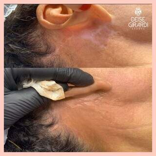 Deise Girardi inova com resultados incr&iacute;veis em est&eacute;tica avan&ccedil;ada