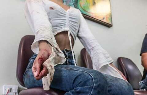 Mutirão de cirurgia plástica atenderá vítimas de violência doméstica