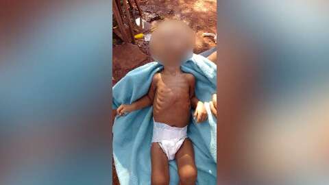 Morte de criança indígena antecipa visita do Ministério da Saúde