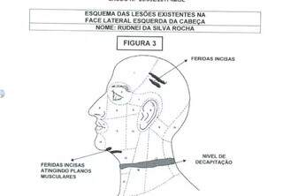 Perícia mostra nível de decapitação da vítima. (Foto/Reprodução)