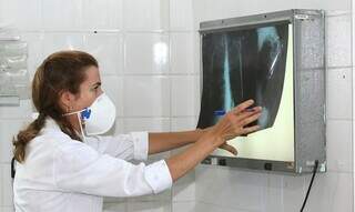 Médica avalia radiografia. (Foto: Reprodução/Agência Brasil)