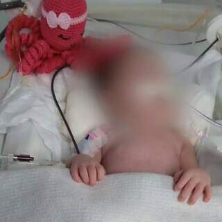 Bebê sofre com condição rara que deixa bexiga e órgãos do abdômen expostos (Foto: Arquivo pessoal)