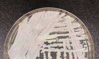 A levedura – tipo de fungo que possui apenas uma célula – causa grande preocupação nas autoridades sanitárias. (Foto: Agência Brasil)