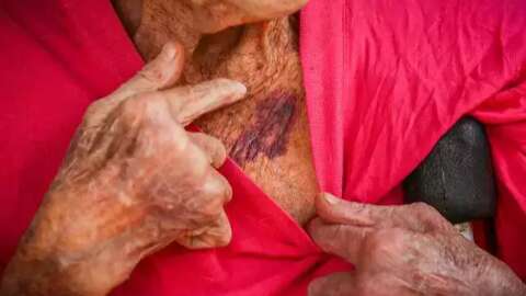 Com 156 casos de violência contra idosos, promotora alerta: "atenção aos sinais"