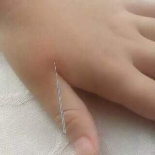 Fabiana explica que agulhas usadas são mais finas do que as utilizadas em coletas de sangue (Foto: Arquivo Pessoal)