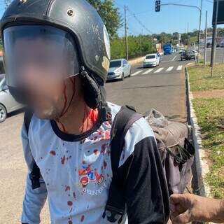 Motociclista ficou ferido depois de ser atacado no trânsito (Foto: Direto das Ruas)
