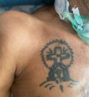 Paciente tem tatuagem no peito (Foto: Santa Casa/Divulgação)