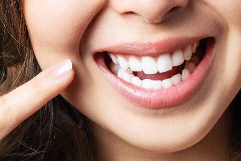 O grande segredo de dentes bons para o resto da vida