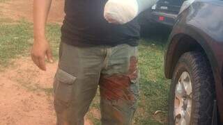 Policial com ferimento de tiro na mão; ele e cinco colegas foram expulsos por narcos (Foto: Divulgação)