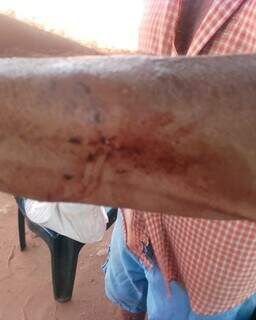 Ferimento no braço de idoso que também foi atacado pelo cachorro. (Foto: Reprodução/Ribas Ordinário)
