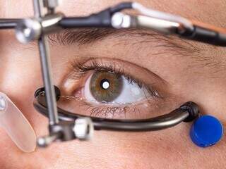 Óculos com um eletrodo inserido dentro do olho para tratamento (Foto: divulgação)