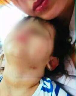 Foto enviada por Stephanie ao marido mostram marcas roxas no pescoço da criança (Foto: Reprodução)