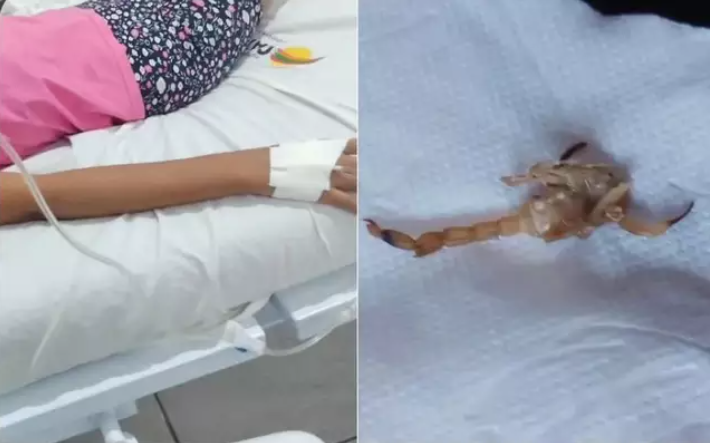 Estado de menina picada por escorpião é crítico e próximas horas serão decisivas