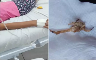 Braço de vítima de escorpião recebendo soro; ao lado, o animal que picou a menina (Foto: Ribas Ordinario)
