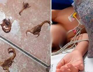 Foto ilustrativa de escorpião e paciente de 8 anos picado em Ribas do Rio Pardo (Foto: Reprodução/Ribas Ordinário)