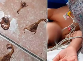Foto ilustrativa de escorpião e paciente picado em Ribas do Rio Pardo (Foto: divulgação)