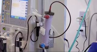 Máquina utilizada em sessão de hemodiálise (Foto: Ministério da Saúde/Divulgação)