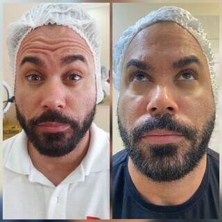 Natal da Royal Face garante botox a partir de R$ 599 para fechar 2023