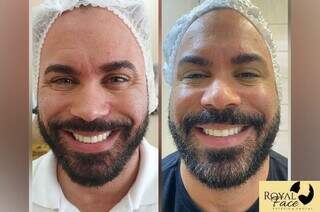Natal da Royal Face garante botox a partir de R$ 599 para fechar 2023