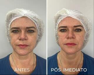 Natal da Royal Face garante botox a partir de R$ 599 para fechar 2023