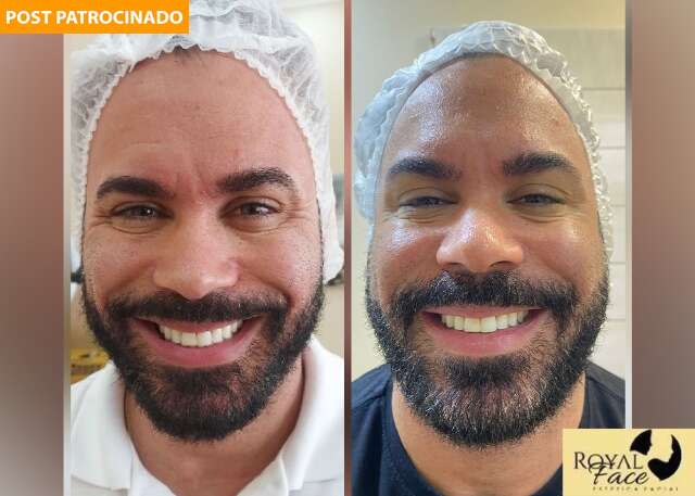 Natal da Royal Face garante botox a partir de R$ 599 para fechar 2023