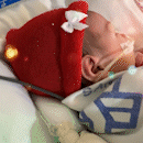 Fofura do dia: enfermeiras fazem gorro de Natal para recém-nascidos da UTI