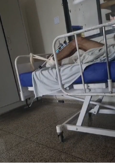 Imagem da perna de José que já passou por cirurgia após cair de uma altura de 6 metros durante trabalho no interior (Foto: Direto das Ruas)