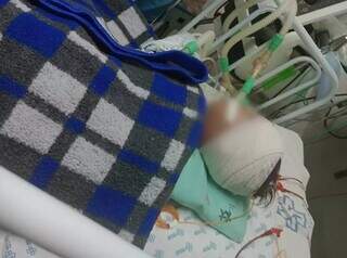 Bebê está internado desde 23 de janeiro e segundo médicos, já não tem reflexos (Foto: Direto das Ruas)  