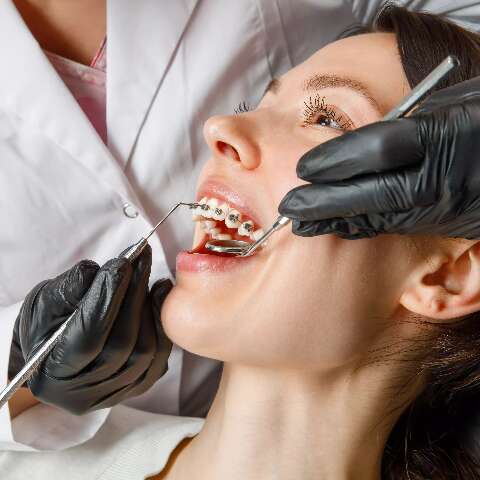 Ortodontia: o que é e sua importância