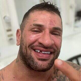 Pobre 'loco' perde dente na raiz durante luta de boxe em SP