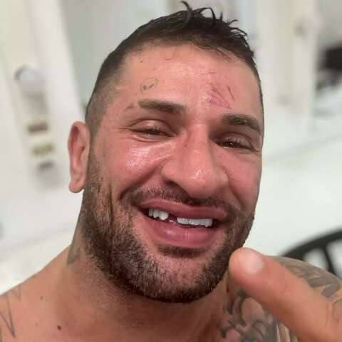 Pobre &#039;loco&#039; perde dente na raiz durante luta de boxe em SP