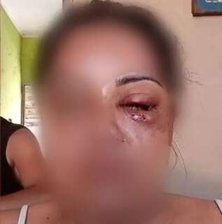 Diarista pede ajuda à vizinha após ser agredida e estuprada por namorado