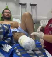 Após perder perna em acidente, policial luta para comprar prótese especial