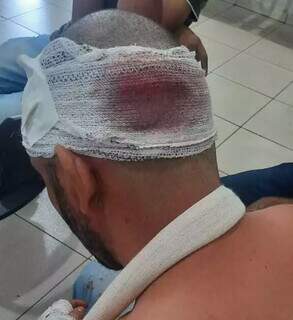 Homem sofreu fratura no crânio durante supostas agressões (Foto: Direto das Ruas)
