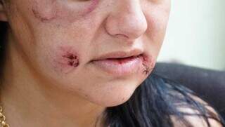 Mulher com sinais de violência doméstica no rosto (Foto: Arquivo/Alex Machado) 