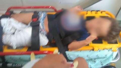 Justiça decreta prisão de pai que chutou e quebrou a perna do filho de 4 anos 