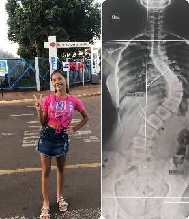 "Abandonada" pelo SUS, adolescente espera 1 ano e meio por cirurgia de escoliose